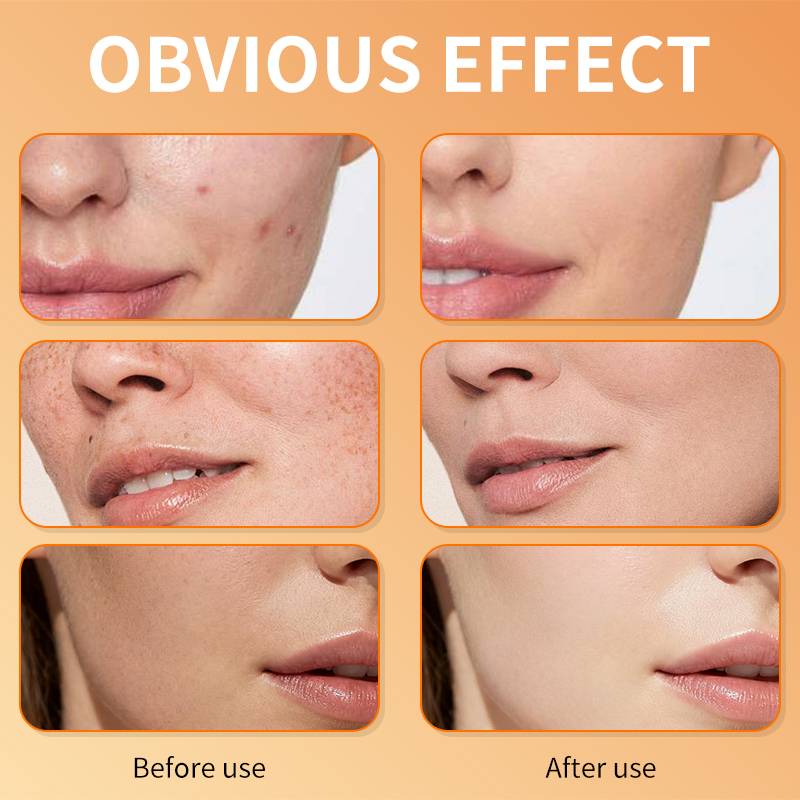 Wholesale Brightening Vitamin C Facial Serum Remove Dark Spots Whitening Serum for Face Skin Care 30ml