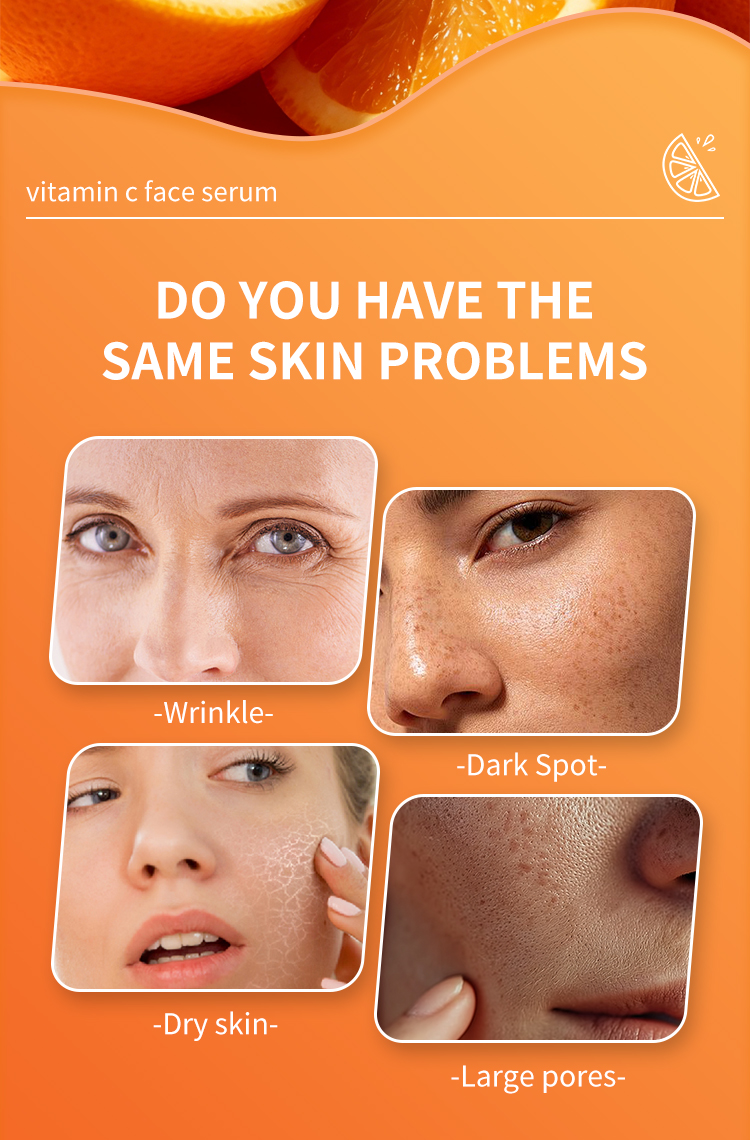Wholesale Brightening Vitamin C Facial Serum Remove Dark Spots Whitening Serum for Face Skin Care 30ml
