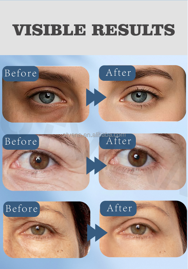 Customized Wholesale Reduce Dark Circles Puffy Tightening Firming Minerals Eye Cream