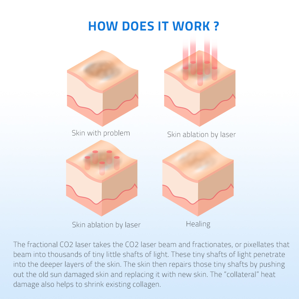 Treatment Process
