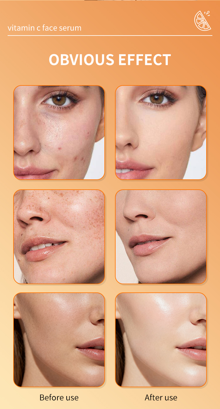 Wholesale Brightening Vitamin C Facial Serum Remove Dark Spots Whitening Serum for Face Skin Care 30ml