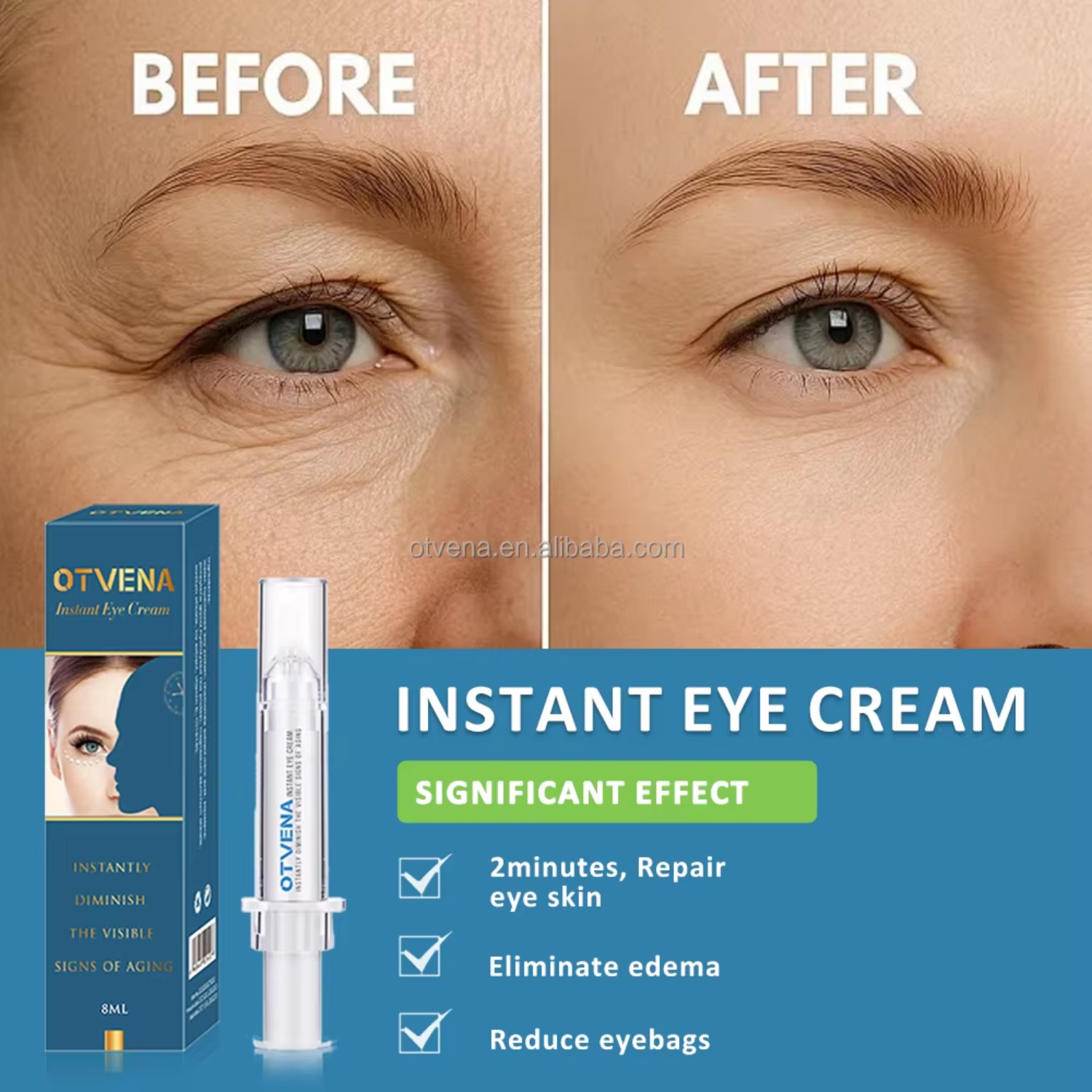 Customized Wholesale Reduce Dark Circles Puffy Tightening Firming Minerals Eye Cream