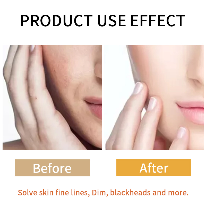 Turmeric Face Skin Care Set Private Label Natural Anti Aging Cosmetic Beauty Products Manufacturer Face Skincare Kit