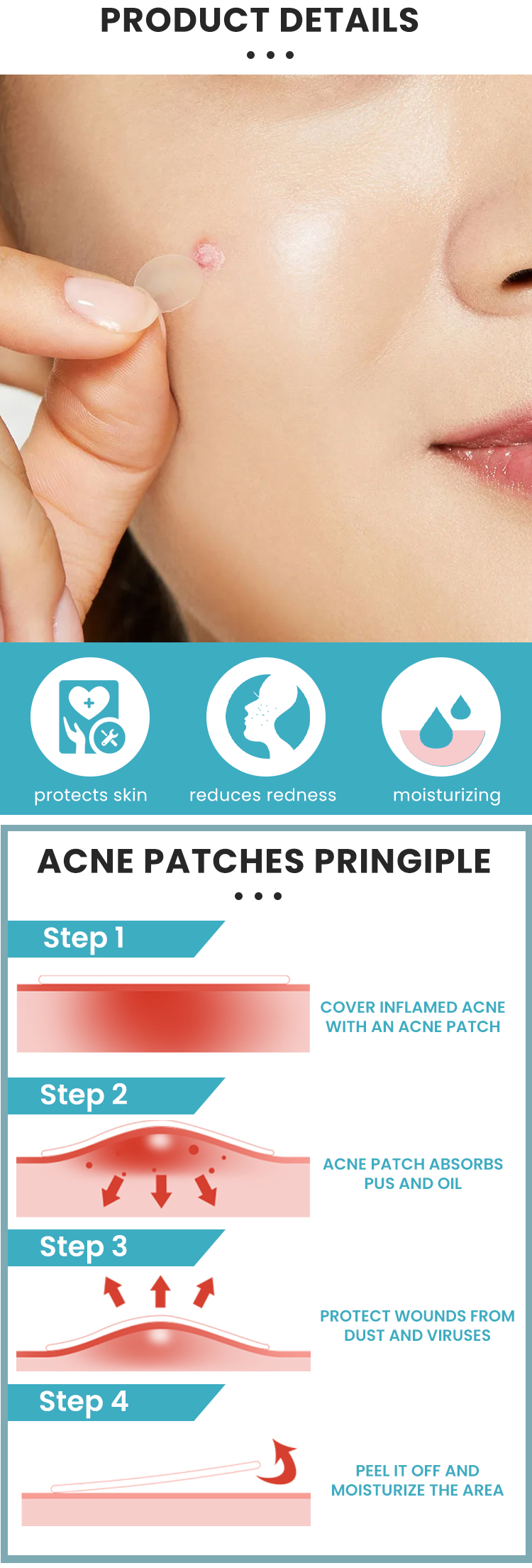 Acne Patch Detail View 1